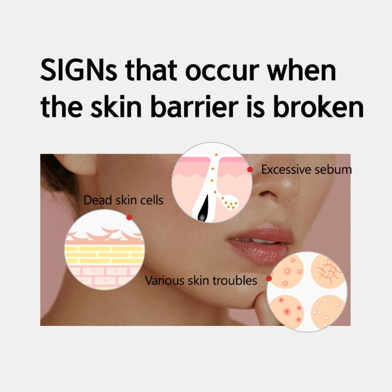 Origin Red Salicylic Acid Spot Cream-NACIFIC-HBYTALA