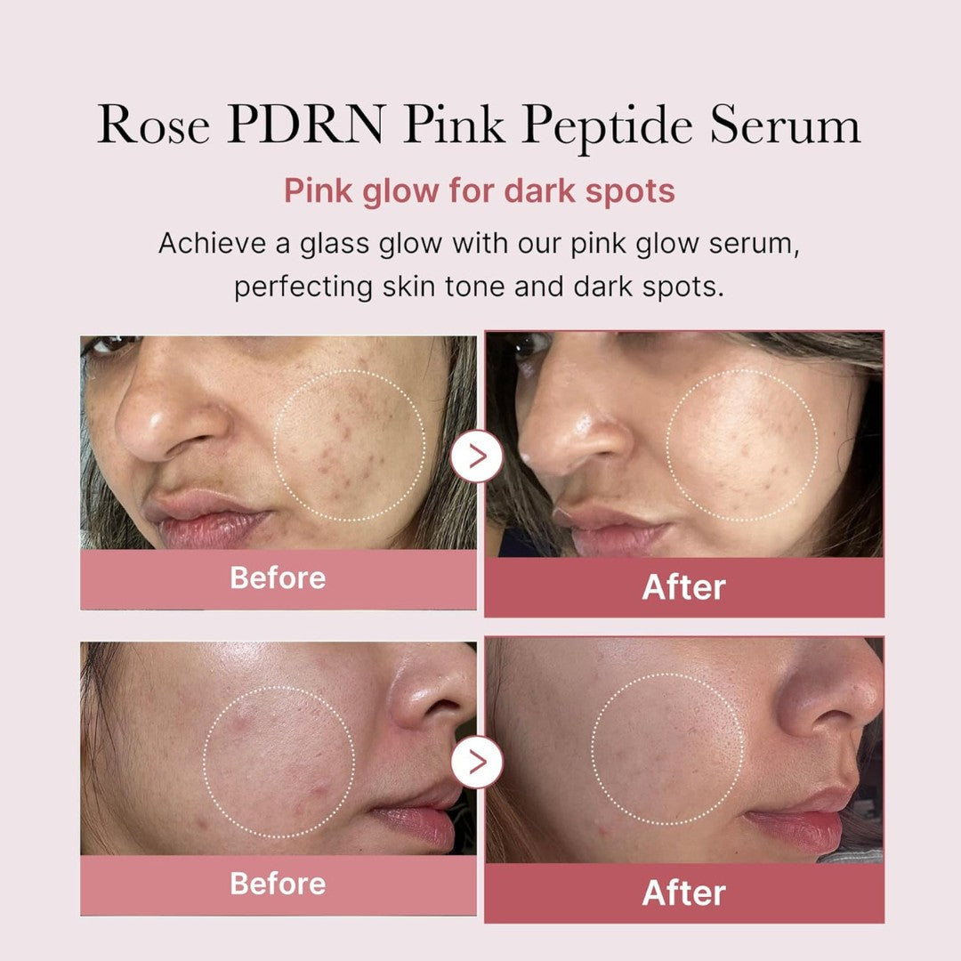 PDRN Pink Peptide Serum-MEDICUBE-HBYTALA