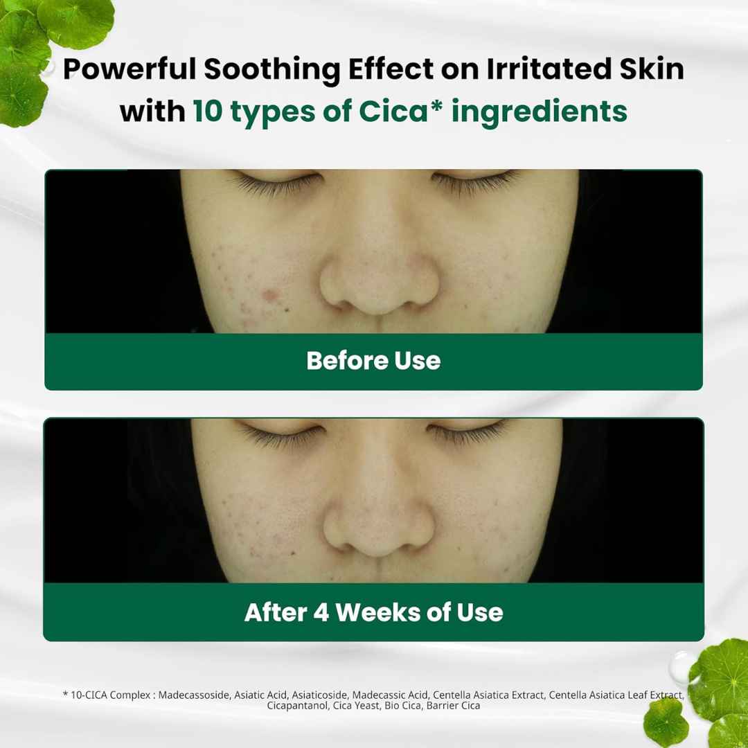 Red Blemish Clear Soothing Cream-DR.G-HBYTALA