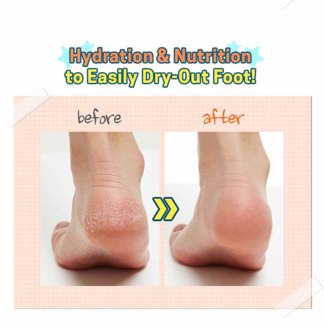 Soft Foot 30 Minute Peeling Socks-APIEU-HBYTALA