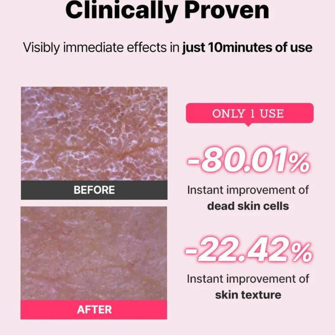 The AHA BHA PHA LHA 35 Peel-COSRX-HBYTALA