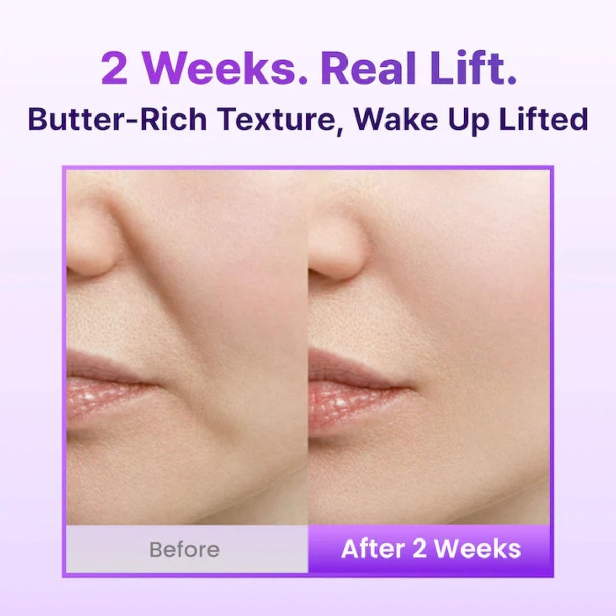 BIOHEAL BOH PROBIODERM™ 3D Lifting Cream-BIOHEAL BOH-HBYTALA