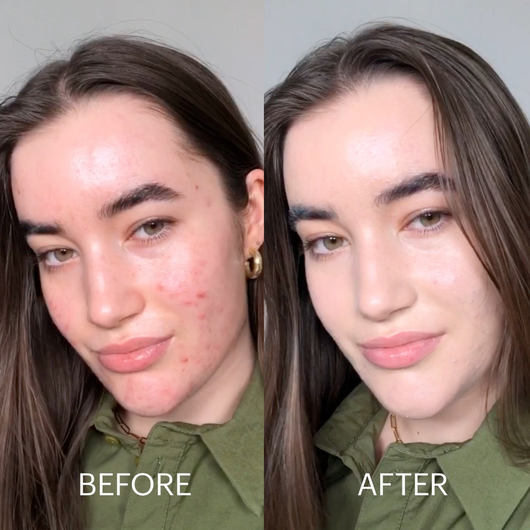 Cicapair™ Tiger Grass Color Correcting Treatment SPF 30-DR.Jart+-HBYTALA