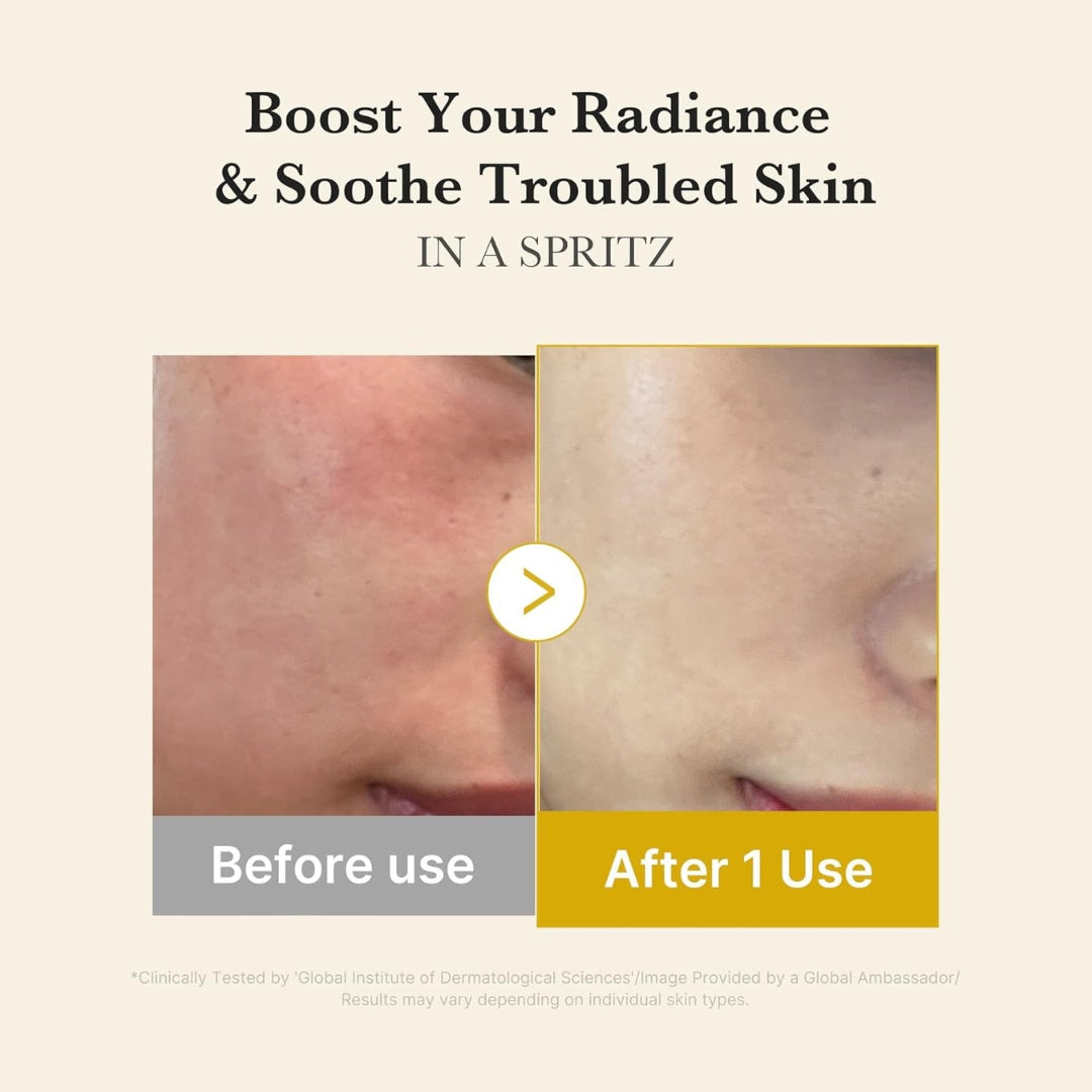 Kojic Acid Turmeric Vita Jelly Mist Serum-MEDICUBE-HBYTALA