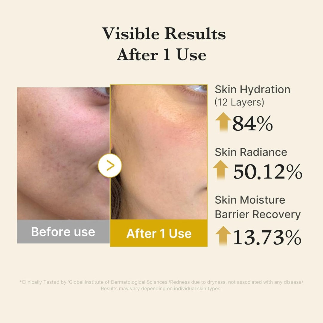 Kojic Acid Turmeric Vita Jelly Mist Serum-MEDICUBE-HBYTALA