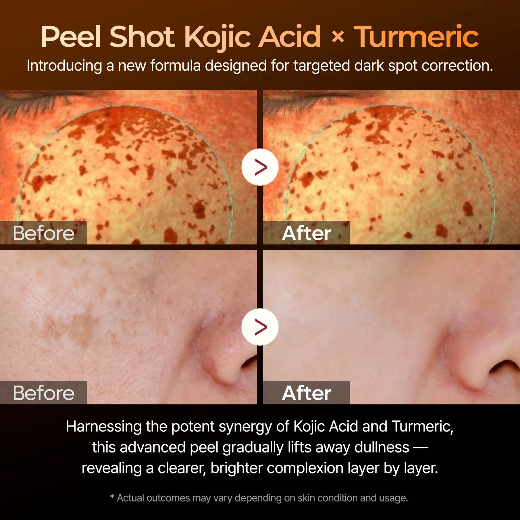 Peel Shot exfoliating kojic acid turmeric Serum 200 ml-DR.MELAXIN-HBYTALA