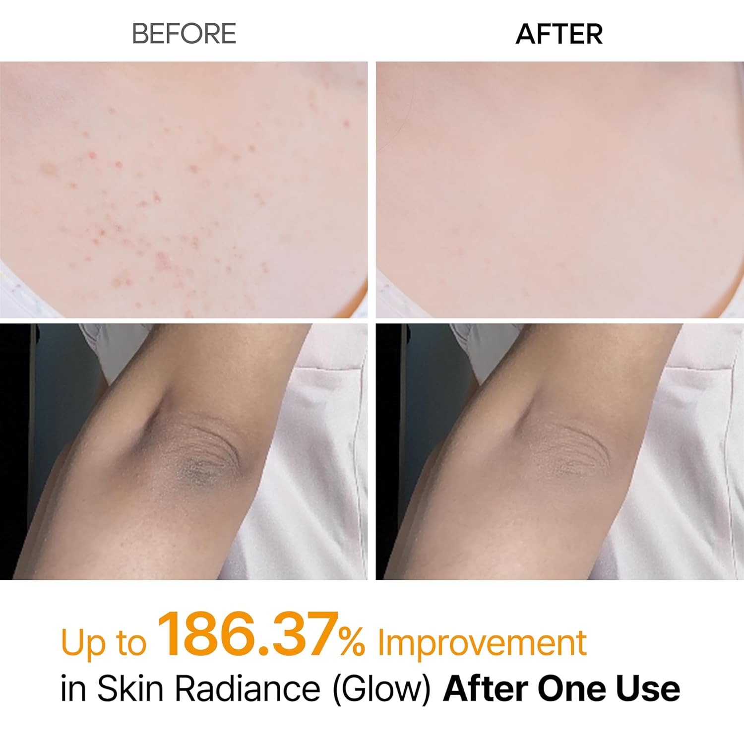 Peel Shot exfoliating kojic acid turmeric Spray 200 ml-DR.MELAXIN-HBYTALA