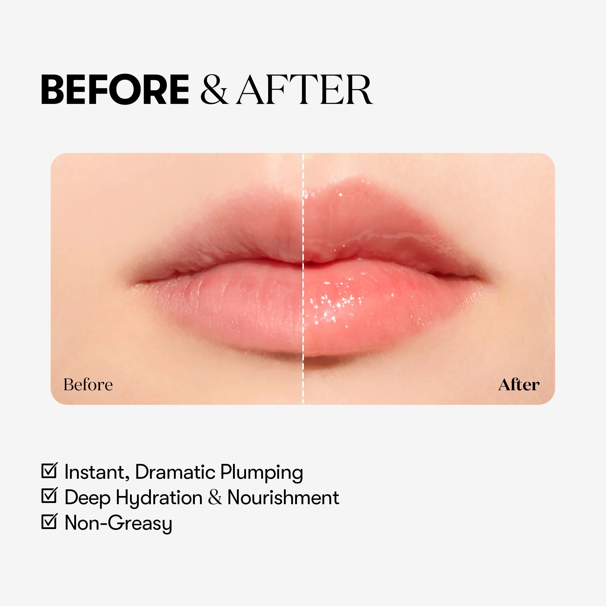 Reedle shot Lip Plumper Expert-VT Cosmetics-HBYTALA