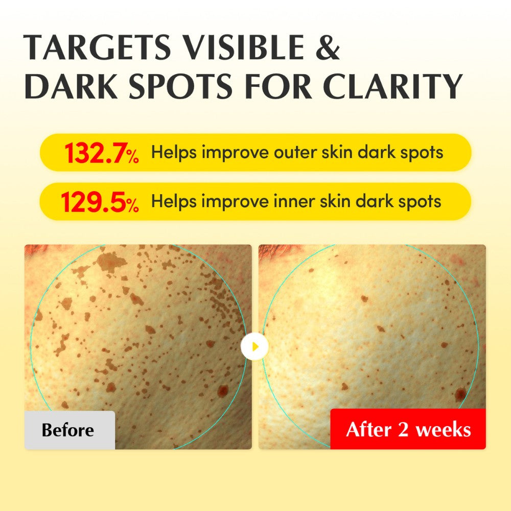 Vitamin illuminating Cream-EQQUALBERRY-HBYTALA